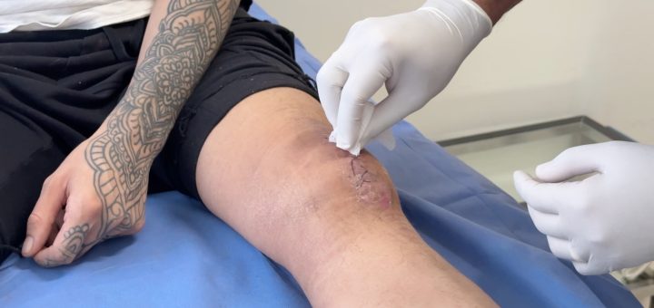 Víctimas de Motos por App en CDMX Denuncian Negligencia de las Plataformas - N+